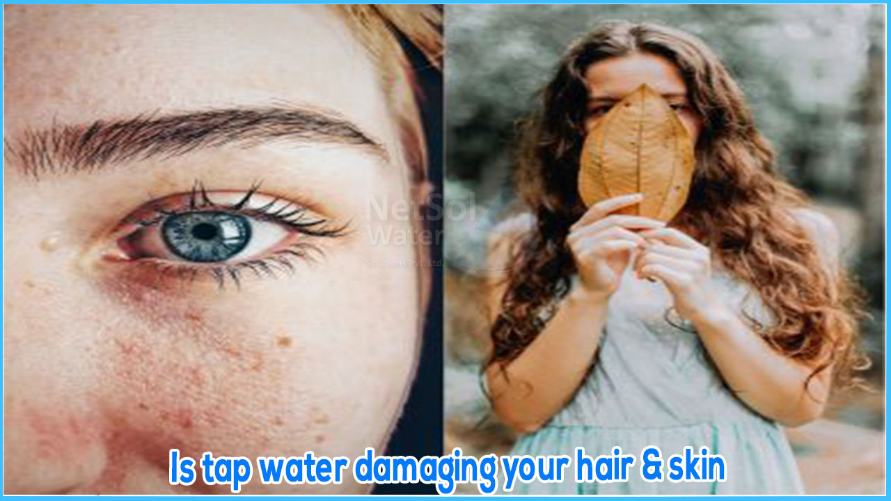 Is tap water damaging your hair &skin? Let’s dive in